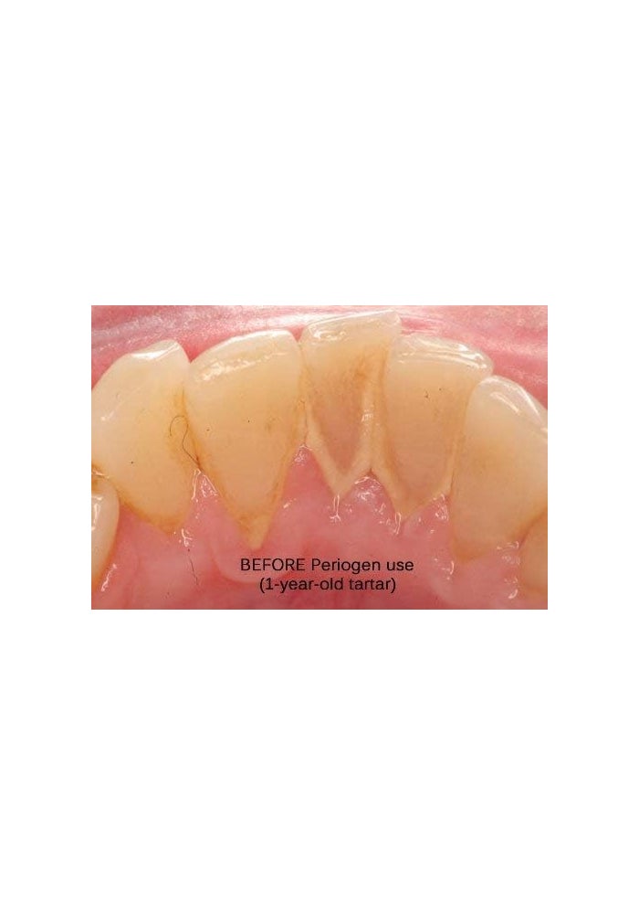 Periogen Complete Oral Health Rinse - 3 Pack for Dental Tartar Reduction - Image 4